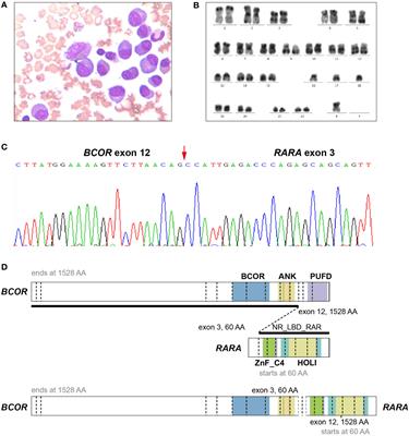 Case Report: Successful therapy with all-trans retinoic acid combined with chemotherapy followed by hematopoietic stem cell transplantation for acute promyelocytic leukemia carrying the BCOR-RARA fusion gene